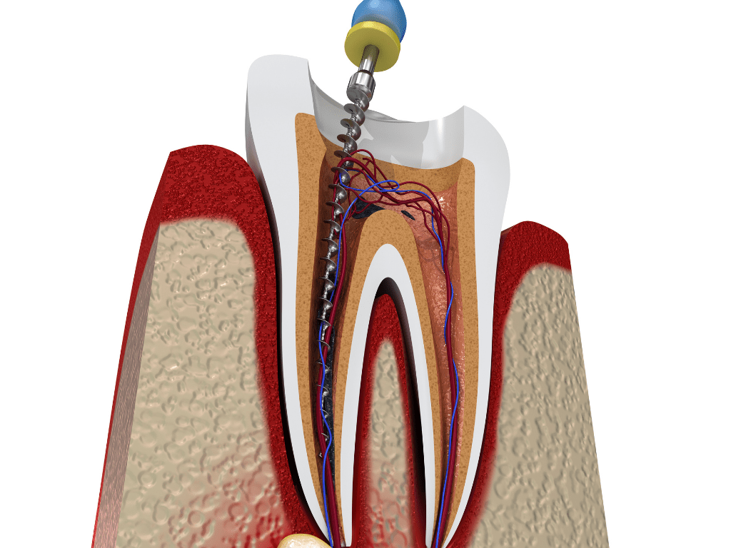 imagine cu interiorul unui dinte