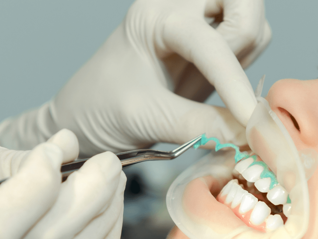 maini cu manusi chirurgicale care indeparteaza de pe dinti o protectie pentru gingii folosita la albirea dintilor