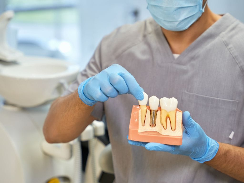medic stomatolog care arata cum se pune un implant dentar